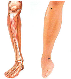 Передней берцовой мышцы ног