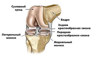 Болит колено спортивная травма